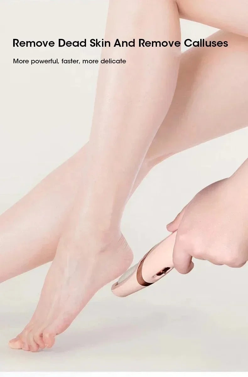 REMOVEDOR DE CALLOS PARA PIES Y CODOS